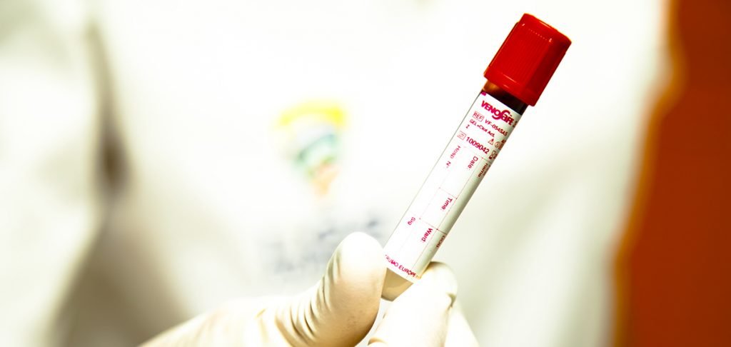 analisis-de-colesterol